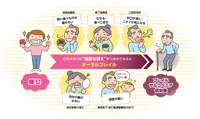 オーラルフレイルのイメージ図