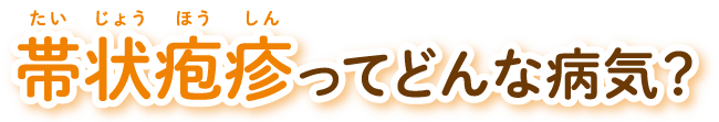 帯状疱疹ってどんな病気？