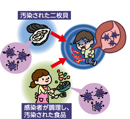 汚染された二枚貝、感染者が調理し汚染された食品